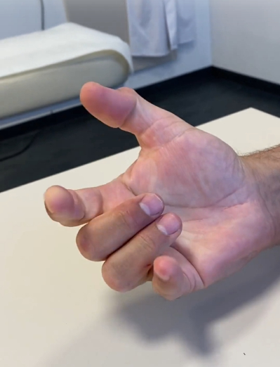 Schnappfinger (Ringfinger & Mittelfinger)